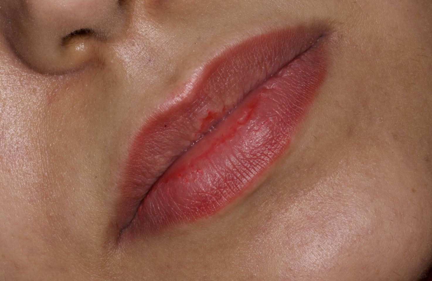 🦷🦷


**إذا كنت صاحب هذا الإعلان وتريد حذفه لأي سبب، رجاءا أرسل رسالة إلى الدعم الفني**