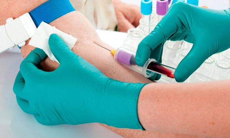 مختبر السنا يوفر لكم كافة الفحوصات المختبرية وبأسعار مناسبة
و الي ماعندة اساعدة 
عنوان المختبر - السبعة كيلو مقابل الشقق السكنية الحكومية
رقم المختبر ***********
