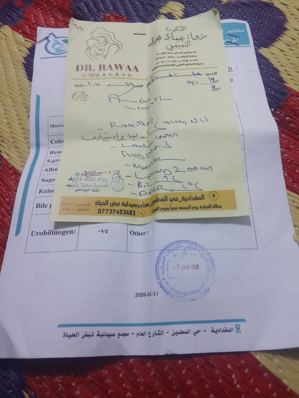 نداء إنساني عاجل.. يا أهل الغيرة والنخوة في ديالى والمقدادية (شهربان)
"مَنْ نَفَّسَ عَنْ مُؤْمِنٍ كُرْبَةً مِنْ كُرَبِ الدُّنْيَا، نَفَّسَ اللهُ عَنْهُ كُرْبَةً مِنْ كُرَبِ يَوْمِ الْقِيَامَةِ"

​إلى أصحاب القلوب الرحيمة، إلى أهلنا في المقدادية (سوق القديم ومنطقة العروبة)، يا من عُرفتم بالكرم والوقوف مع المحتاج في أحلك الظروف.

​بيننا اليوم عائلة متعففة تعيش وضعاً مأساوياً؛ امرأة صابرة، أم لـ 7 أطفال، تعاني من مرض شديد وتفتقر لأبسط مقومات العلاج. هي بحاجة ماسة لعملية (زراعة) تكلف 150 ألفاً، وهو مبلغ تعجز الجبال عن حمله فكيف بعائلة تسكن "بالإيجار" ويثقل كاهلها الديون، وزوجها لا يملك من حطام الدنيا شيئاً؟

​هذه المرة، النداء ليس مجرد كلمات، بل هو استغاثة بـ "بخت" أهل شهربان وشهامتهم. هذه المرأة هي أختكم وابنتكم، وأطفالها السبعة ينتظرون من يمسح دمعتهم ويعيد لوالدتهم عافيتها.

​لأهل المنطقة في العروبة وسوق القديم:

يمكنكم الاطلاع بأنفسكم على الحالة والتقارير الطبية للتأكد من كل التفاصيل. المصداقية هي أساس عملنا، وهدفنا هو إنقاذ هذه الروح.

​من يريد المساهمة، ولو بالقليل، أو من يعرف جهة خيرية يمكنها التكفل بالعملية، يرجى التواصل معنا فوراً.

​"والله في عون العبد ما كان العبد في عون أخيه"

​أرجو من الجميع "مشاركة" (Share) للمنشور ليصل إلى أكبر عدد من المحسنين.. لعلّ الله يجعل شفاءها على يد أحدكم.

​للتواصل والاستفسار: [***********]

ماستر (6345935594)

​#المقدادية #ديالى #شهربان #منطقة_العروبة #عمل_خيري #نداء_إنساني
