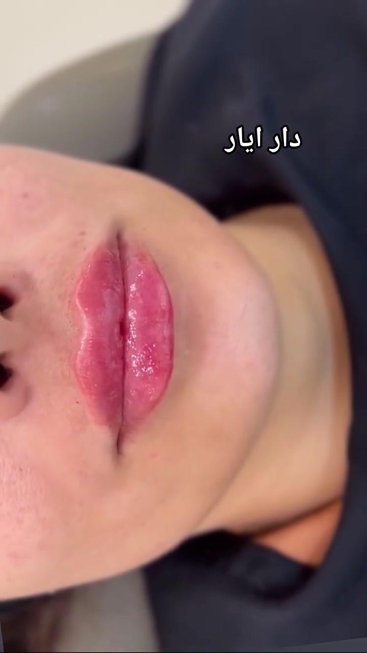 عروضنه متخلص يابنات ***********
50%تخفيضات
