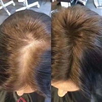 زيت شعر • يوقف التساقط • توصيل مجاني