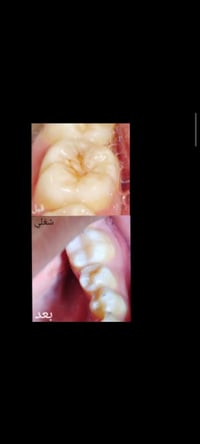 علاج مجاني • عيادات جامعة النور • خدمات أسنان