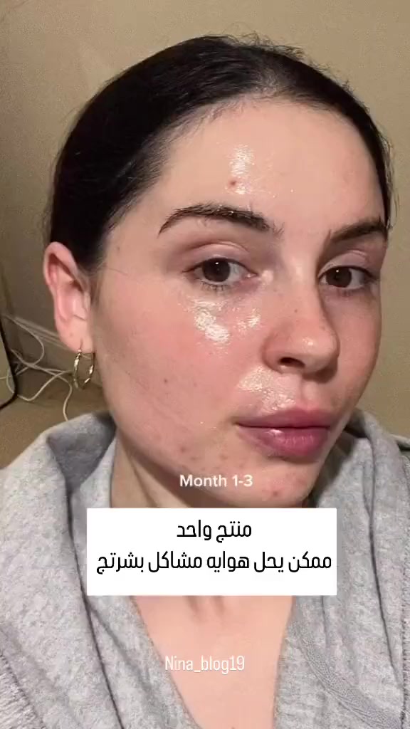 للحجز تفضلوا خااص


**إذا كنت صاحب هذا الإعلان وتريد حذفه لأي سبب، رجاءا أرسل رسالة إلى الدعم الفني**