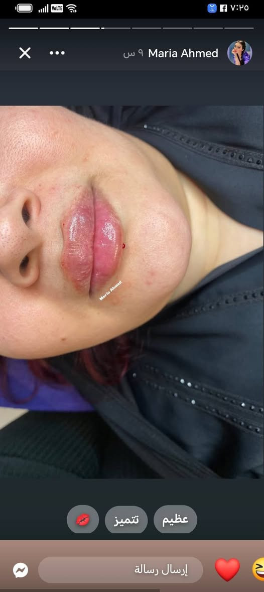 تم تمديد العرض ماكو احله من هيج دلل عاشت ايداج maria Ahmed


**إذا كنت صاحب هذا الإعلان وتريد حذفه لأي سبب، رجاءا أرسل رسالة إلى الدعم الفني**