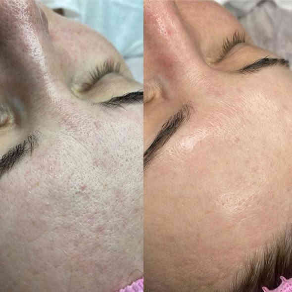 اهلا وسهلا  عروض  نار
عروض رأس السنه🎉 
عروض مميزه💃🏻🎊
اسعارناً مناسباً 📍✨
عروس حنه وزفه250💃🏻💃🏻💃🏻
فقط زفه 150🎈💃🏻
فقط حنه 100🎎🔥🎉🎊🎈💃🏻
المدعوات 25🎊💃🏻🎈🎈
تنظيف البشرة هايدرو ب10 💃🏻🎊
تنظيف البشرة ملكي ب15🎉
تنظيف  اليد 8🥳💃🏻💃🏻💃🏻💃🏻💃🏻
حفافة 5
شمع للوجه  8
بديكير 10 مع املاح طبيعية 
الماكير 25🎈🎈🧸
سحب لون شعر قصير 10 واسط 20فما فوق حسب طول الشعر
صبغ شعر قصير جداً 15 💃🏻🎎🔥المتن 20 الوسط 25 الطويل حسب طول الشعر 
ميش كثيف قصير 20 فما فوق حسب طول الشعر 🎎🔥💃🏻
تسريح الشعر يخلي شعرج سرح حسب طول الشعر 
قص 5 اي قصه 
معالج لترميم وتغذية الشعر القصير 25 فما فوق حسب طول الشعر🎉🎊🎈
اهلا وسهلا بلجميع 
صالون الين
العنوان//كربلاء حي الرباب قرب سيد سماعيل 
الحجز //***********
***********
