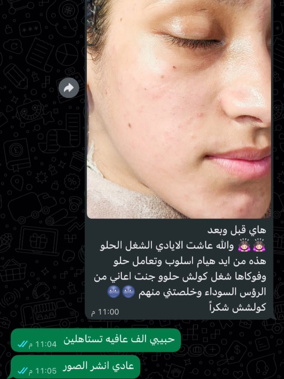 ✔ تنظيف عميق للمسام
✔ إزالة الرؤوس السوداء بدون ألم
✔ تعقيم بالأوزون

النتيجة: بشرة نظيفة، صافية ولمعة صحية من أول جلسة 💎

📍 العنوان: البياع ش12 تقاطع الحمام خلف مكتبة ميم
📞 ***********
