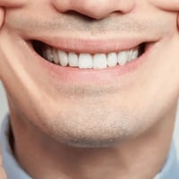 متوفر علاج #مجاني للحالات التالية #تنظيف اسنان  #قلع اسنان #تعويض اسنا...