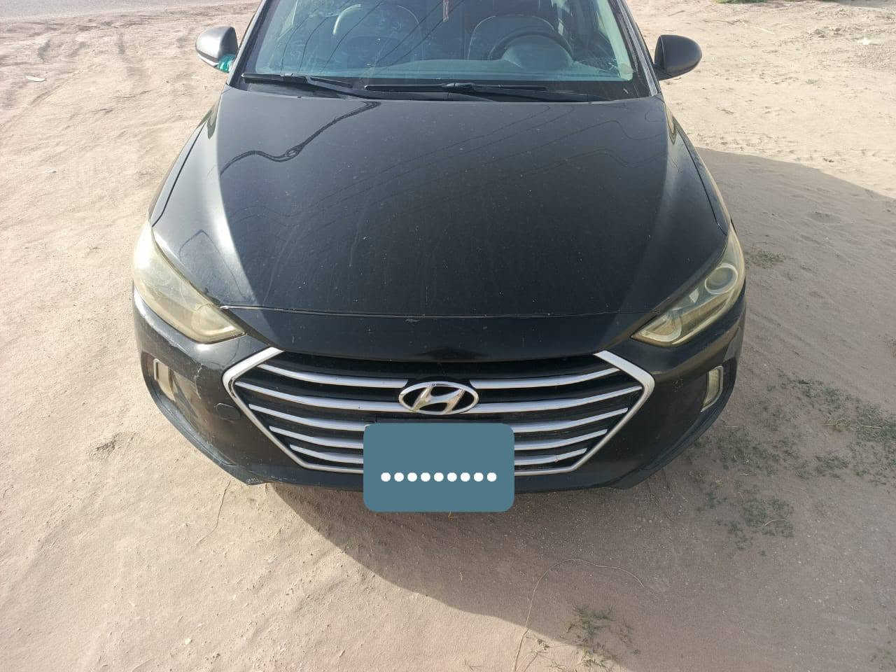 النترا 2017 امريكي رقم بغداد باسمي حادث امريكا خفيف بجم كبس فول عده الفتحه بصمه تحكم استيرن نقاط عمياء تدفئة كشنات 3 وضعيات قياده
منضومة غاز 
السعر 105 وبيها مجال للشراي سونارها وصور حادثها منشوره
النترا 2017 امريكي رقم بغداد باسمي حادث امريكا خفيف بجم كبس فول عده الفتحه بصمه تحكم استيرن نقاط عمياء تدفئة كشنات 3 وضعيات قياده


**إذا كنت صاحب هذا الإعلان وتريد حذفه لأي سبب، رجاءا أرسل رسالة إلى الدعم الفني**