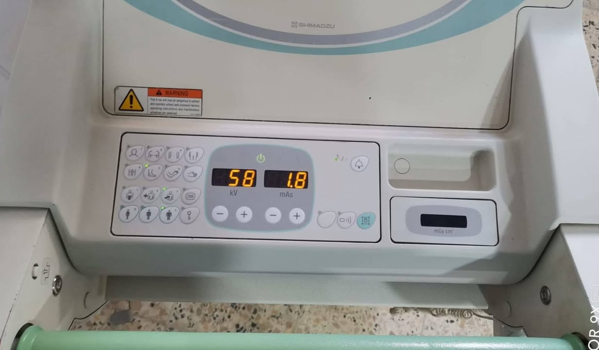 🔥 جهاز أشعة متنقل ياباني – Shimadzu MobileArt Evolution 🔥
اختيار مثالي للمستشفيات، الطوارئ، والعناية المركزة
🔹 الموديل: MobileArt Evolution
🔹 المنشأ: يابان 🇯🇵
🔹 النوع: جهاز أشعة X-Ray متنقل (Mobile)
✅ المواصفات الفنية:
قدرة عالية للتصوير بجودة ممتازة
kVp: حتى 133
mA: ثابت ومستقر لصور واضحة
أنبوب أشعة أصلي من Shimadzu
تحكم إلكتروني سهل وسريع
شاشة تحكم واضحة وسهلة الاستخدام
حركة انسيابية وعجلات قوية تناسب العمل داخل الأقسام
مناسب للتصوير داخل:
الطوارئ
العناية المركزة (ICU)
الردهات وغرف المرضى
⭐ المميزات:
صورة عالية الدقة
اعتمادية يابانية معروفة
تقليل جرعة الإشعاع
صيانة سهلة وتوفر قطع غيار
عملي جداً للعمل اليومي المكثف
📌 الحالة: جاهز للعمل
📌 الفحص: مفحوص ومجرب بالكامل
📞 للاستفسار والتواصل:
(***********)
