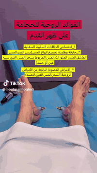 حجامة بسمايه الصحيه
لعلاج الضغط والصداع والشقيقه والام الظهر والدسك والفقرات وعرق النسا والمتن للاطفال وشلع السره وللحجامه تعالج ضعف النظر والتهاب الجيوب 
والام القدم وعلاج النتوء كل هذا وصحه وعافيه على الجميع 
واكيد الحجامه وقايه وعلاج
***********
