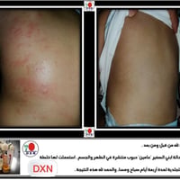 مكياج • حالة زينة • نتيجة واضحة