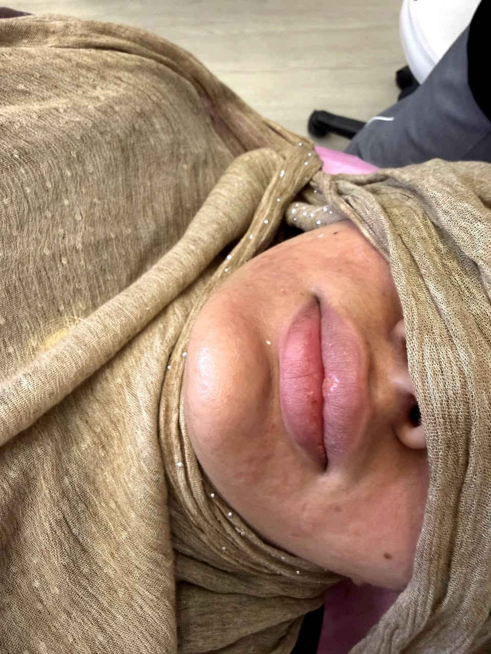 ‏✨شغلي بالتجميل مو بس مهنة✨…هو فن🥰
‏يبرز جمال كل وحدة بطريقة ناعمة ومميزة.😍
‏أهتم بأدق التفاصيل، لأن الجمال الحقيقي يكمن في البساطة والإتقان.
‏#عيادةالدكتورةنبأمكي 😍
‏لطب وتجميل وزراعة الأسنان🦷
‏والحقن 💉والتجميل اللاجراحي🩹💉
‏احجزي موعدك وخلي جمالك يحكي لكِ 🤍
‏
‏📍العنوان_الأعلام شارع البدالة_ مجمع القمة الطبي
‏☎️ ***********
‏
