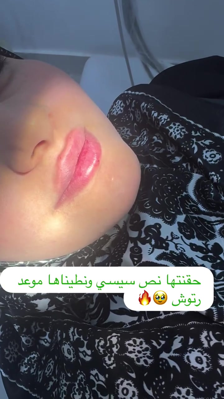 اجتي المراجعة وهي مقهورة حاقنة بغير مكان ومامسويلها رسمة وجانت كلها ثقة بعيادتنة شتكولون گدرنة نحقق طلبها  ونكون گد الثقة 🥹🤩
🔥🔥شارع البلداوي مقابل الباب الرئيسي لمدرسة القحطانية مجمع الأمل الطبي الطابق الاول 
🔥🔥🔥للحجز ***********
