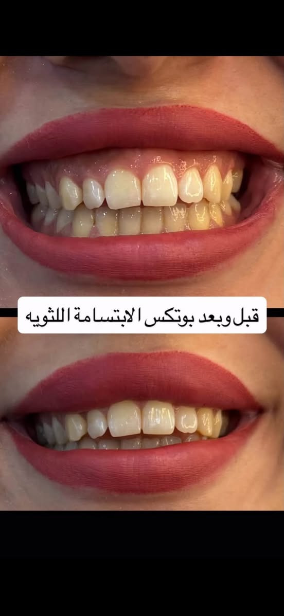 نستقبلكم بكل حب بعياده كنز الابتسامه
نزله گميرةفوق صيدليه ليث صباح  مقابل علوة ابو محمد 
للاستفسار. الاتصال او مراسلة الرقم ***********
