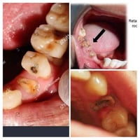 الي عندة هيج أسنان ويحتاج قلع يتواصل عبر هذا الرقم علما أن العلاج مجان...