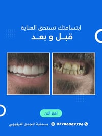 كشف أسنان • مدينة بسماية • المجمع الترفيهي