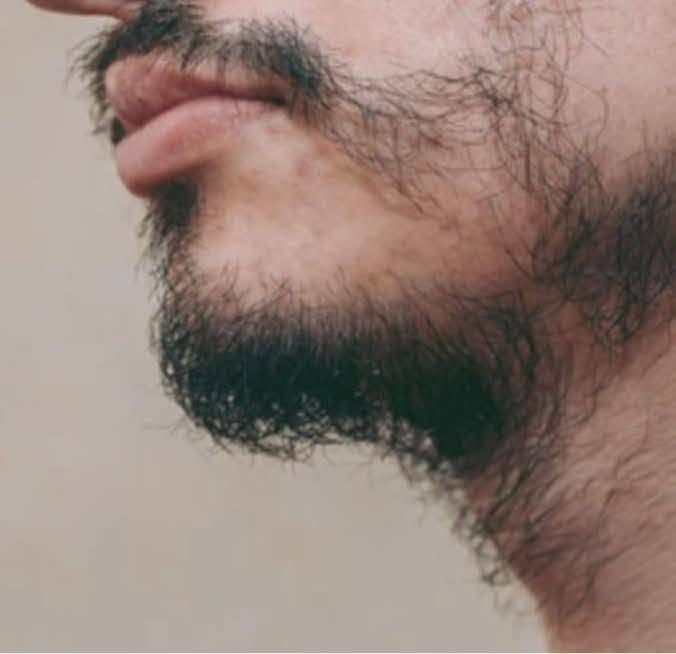 🌿 الحل المتكامل لشعر قوي ولحية كثيفة.. في بار واحد! 🧔🏻‍♀️🧔🏻
​هل تعبت من مشاكل تساقط الشعر، الفراغات، أو ضعف نمو اللحية؟ حان الوقت للتخلي عن المنتجات الكيميائية العشوائية واعتماد العلاج الطبيعي المكثف مع الشامبو بار (Shampoo Bar) العلاجي.
​هذا البار ليس مجرد منظف، بل هو تركيبة مركزة ومدروسة غنية بالزيوت العلاجية والأعشاب الطبية التي تستهدف بصيلات الشعر مباشرة لتمنحك نتائج ملحوظة للشعر واللحية على حد سواء.
​✨ الفوائد العلاجية الخارقة (للشعر واللحية):
​🚫 إيقاف التساقط من الجذور: يعمل على تقوية البصيلات الضعيفة وتثبيتها، مما يقلل التساقط بشكل ملحوظ منذ الأسابيع الأولى.
​🌱 تحفيز نمو شعر جديد (إنبات الفراغات): ينشط الدورة الدموية في فروة الرأس ومنطقة اللحية، مما يساعد على ملء الفراغات وظهور شعر جديد وصحي.
​💪 تكثيف وتقوية الشعرة: يغذي ألياف الشعر والفراغات بالفيتامينات الأساسية، مما يزيد من سمك الشعرة وكثافة المظهر العام.
​🛡️ علاج مشاكل الفروة والجلد: يقضي على القشرة، الحكة، والالتهابات التي تعيق نمو الشعر، ويوازن إفراز الدهون الطبيعية.
​✨ نعومة ولمعان طبيعي: يعيد الحيوية للشعر الباهت والتالف وللشعر الخشن في اللحية، ليجعلها أكثر ترتيباً وسهولة في التصفيف.
​🧪 لماذا يتميز الشامبو بار العلاجي الخاص بنا؟
​💡 تركيبة طبيعية مركزة: على عكس الشامبو السائل الذي يتكون من 80% من الماء والمواد الكيميائية، الشامبو بار الخاص بنا عبارة عن خلاصة صافية من المواد الفعالة والزيوت الطبية، خالي تماماً من السلفات والبارابين لضمان أمان تام وفائدة قصوى.
​📝 طريقة الاستخدام الفعالة:
​بلل الشعر أو اللحية بالماء الدافئ.
​دلك البار مباشرة للحصول على رغوة غنية وكثيفة.
​مهم جداً: اترك الرغوة تعمل وتتغلغل لمدة 2 إلى 3 دقائق لامتصاص المكونات العلاجية قبل الشطف.
​📥 لأن شعرك ولحيتك يستحقان الأفضل.. اطلب منتجك الآن!
تواصل معنا عبر رسائل الصفحة أو اتصل بنا مباشرة على الرقم: 0655931557 📞
​#عناية_بالشعر #عناية_باللحية #إنبات_الشعر #منع_التساقط #شامبو_علاجي #طبيعي_100


**إذا كنت صاحب هذا الإعلان وتريد حذفه لأي سبب، رجاءا أرسل رسالة إلى الدعم الفني**