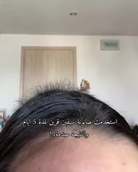 صابونة طبيعية • تساقط شعر • توصيل مجاني