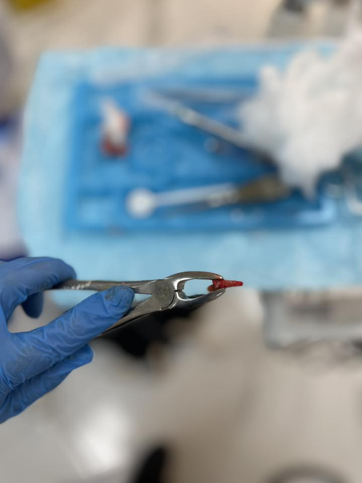 اي احد عنده جذور باقيه بأسنانه او عنده سن يريد يقلعه يتواصل وياي على الخاص او على هذا الرقم 
*********** القلع مجاناً العنوان جامعه العين  تحت اشراف اطباء اختصاص
