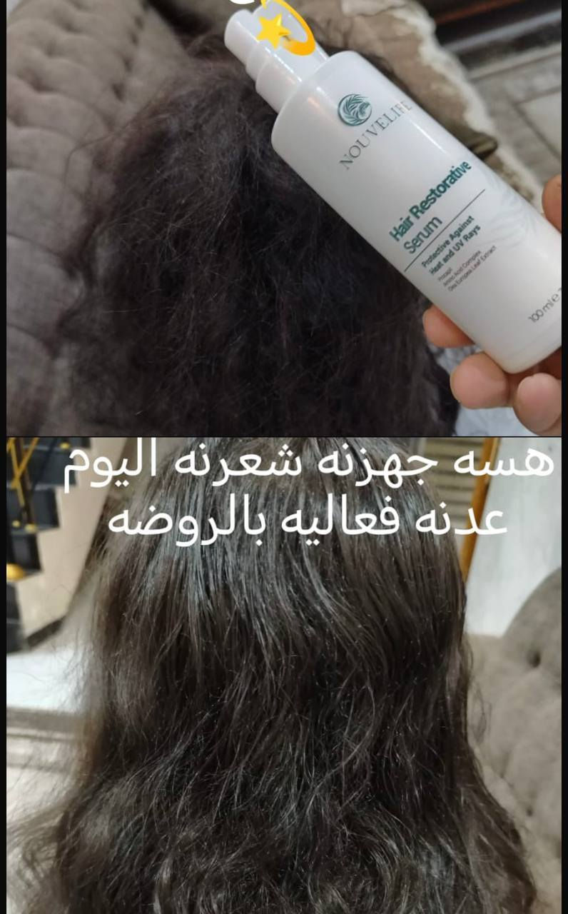 تجربه زبونتي لسيروم الشعر 🌺🌺🌷♥️❤️💜


**إذا كنت صاحب هذا الإعلان وتريد حذفه لأي سبب، رجاءا أرسل رسالة إلى الدعم الفني**