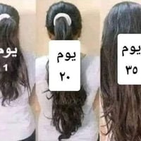 نمو شعر • خالي فراغات • نتيجة ١٥ يوم
