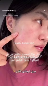 باكوتشيول • بديل ريتينول • EQQUALBERRY