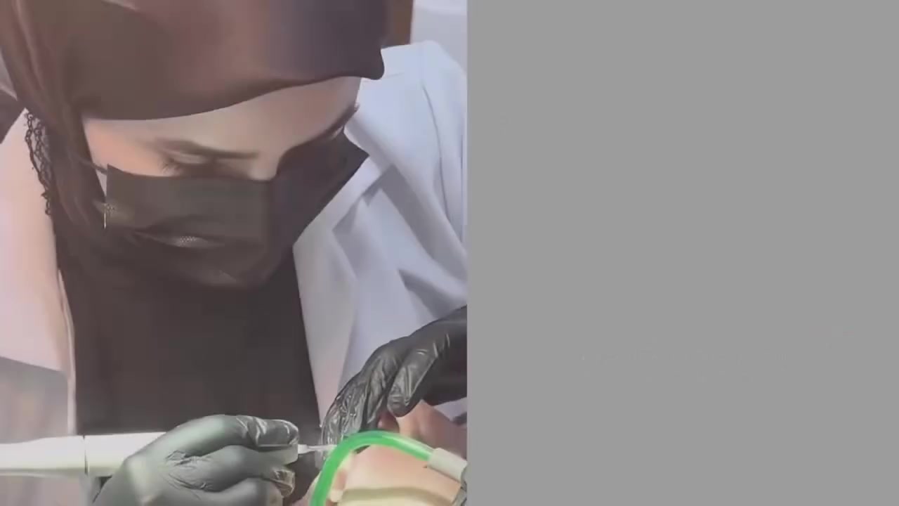 مجاناً ❗️❗️
تُعلن عيادات طب الاسنان جامعة العميد للعتبه العباسية 
عن استقبال المراجعين مجاناً وبالحالات الآتيه 
حشوات تجميلية 
قلع الاسنان التالفة والجذور 
حشوات وقلع للاطفال وجلسات فلورايد لمحاربة التسوس
تعويض الاسنان المفقوده بطقم متحرك 
للاستفسار والتواصل ماسنجر او واتساب  : 
***********
