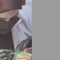 مجانا • جامعة العميد • حشوات تجميلية