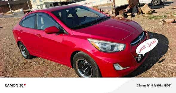 للبيع هيواندي اكسنت موديل 2016محرك كير شرط ماشيه 53الف ميل ورد أمريكي بدون صبغ سونار موجود بس بيها ملاحضتين فقط رقم سنويا هزة جديد حتى فحص مرور جديد السيارة مابيها اي نقص السعر 103ورقه بيها مجال قليل ***********واتساب موجود موصل
