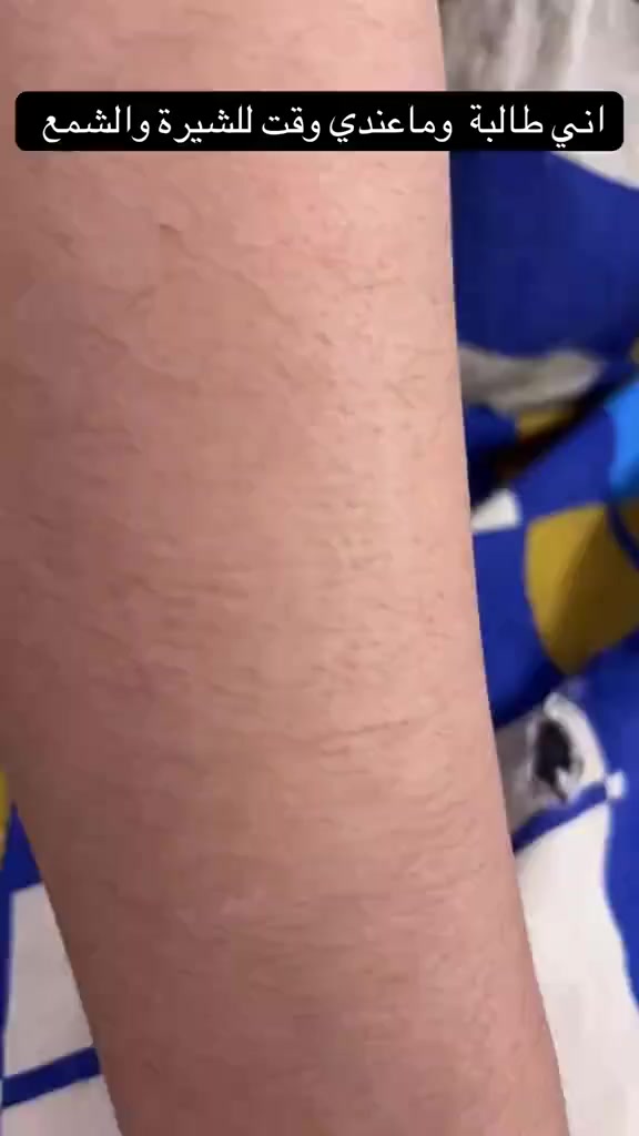 بودرة إزالة الشعر NOVIN BARTA 507 هي منتج مخصص لإزالة الشعر الزائد بسهولة وأمان، بتركيبة فعّالة تساعد على إزالة الشعر من الجذور وترك البشرة ناعمة وملساء.
تتميز برائحة زهور تايلاند المنعشة التي تقلل من الإحساس القوي المعتاد في منتجات إزالة الشعر، مما يجعل تجربة الاستخدام أكثر راحة.
المميزات:
مناسبة لمناطق الجسم المختلفة (اليدين، الساقين، الجسم).
تمنح نعومة تدوم لفترة أطول.
سهلة التحضير والاستخدام.
#اكسبلور #اكسبلورر_2021 #لقطة #من_تصوير #اكسبلور_2021 #يارب #حب #كانون #اكسبلور_explored #اكسبلور_لايك #عرب_فوتو #تصويري #صور #عدستي #لايك #كميرا #بحر #هاشتاق #اكسبلور #دعم #تفاعل #لايكات #كومنت #كومنتات #اكسبلور مسك وعنبر


**إذا كنت صاحب هذا الإعلان وتريد حذفه لأي سبب، رجاءا أرسل رسالة إلى الدعم الفني**