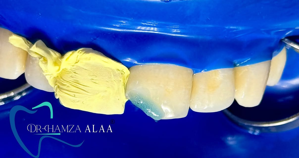 العنوان بسمايه الشارع العام 📍
للحجز والأستفسار مراسلة الصفحة او عن طريق الواتساب *********** 📞
