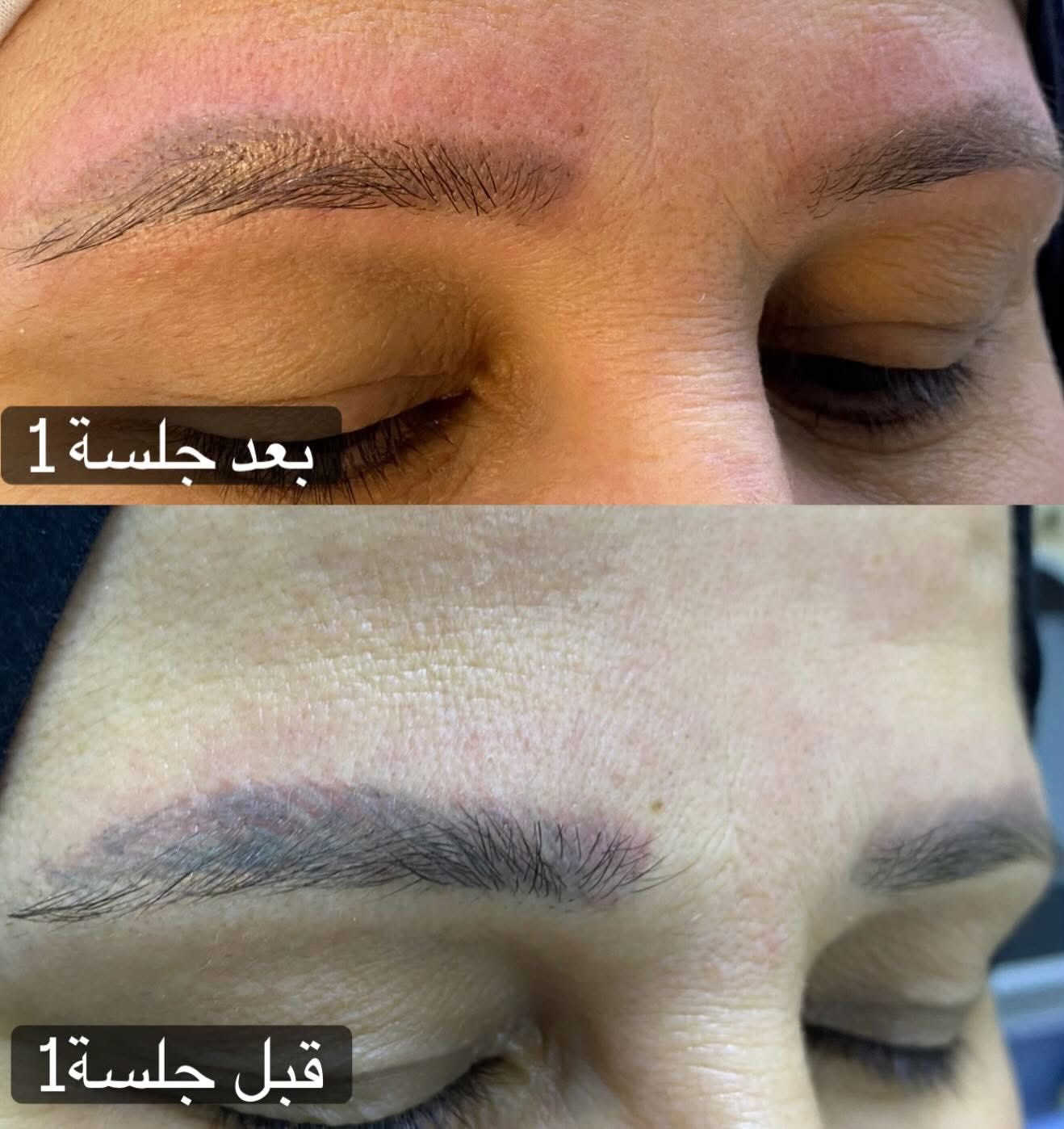 تاتو بلوك 15رموش كامله 10طرفيه 5مسح تاتو قديم 10توريد شفه 15


**إذا كنت صاحب هذا الإعلان وتريد حذفه لأي سبب، رجاءا أرسل رسالة إلى الدعم الفني**