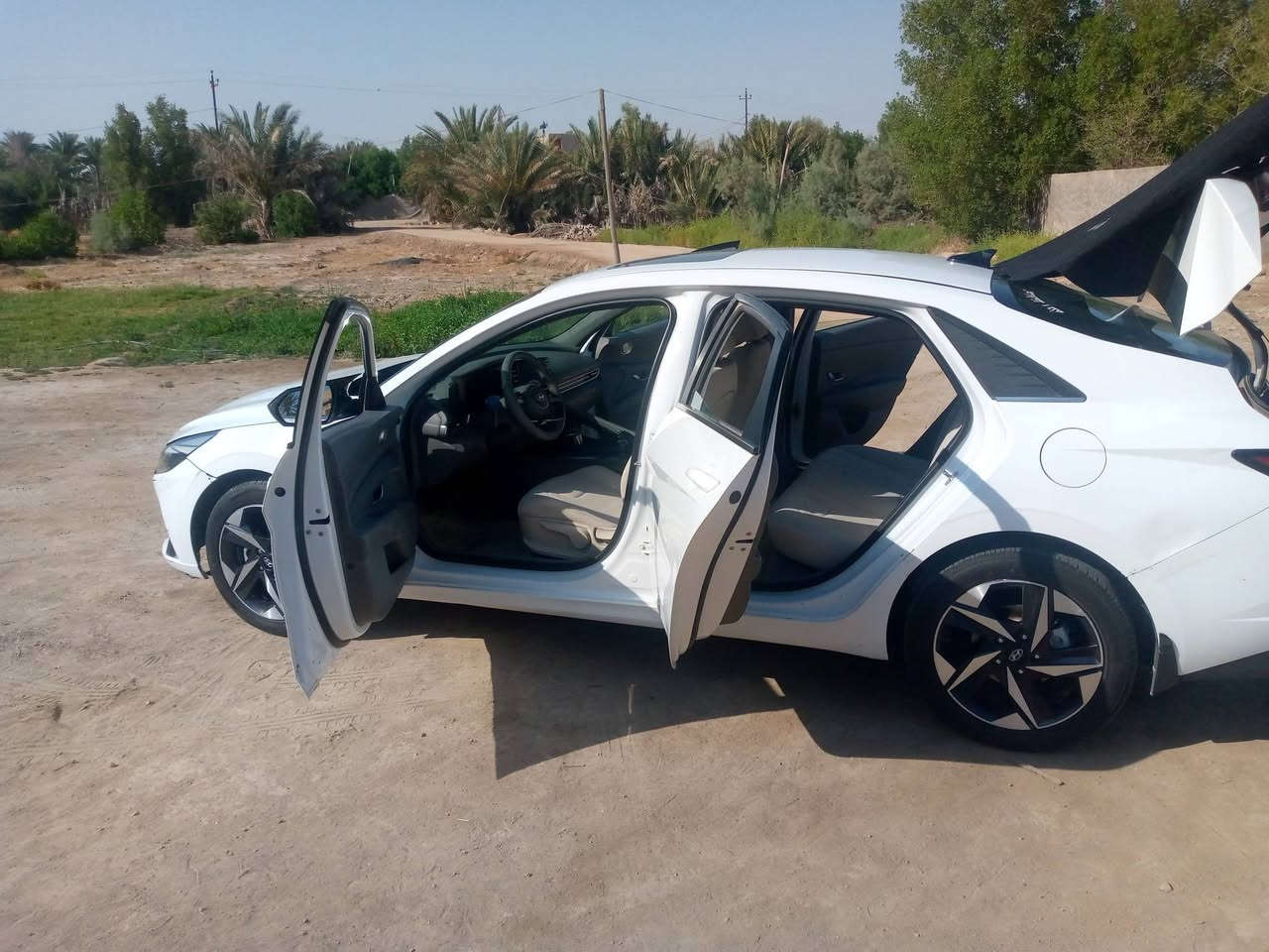 النترا خليجي موديل 23 مكينه الفين مجفته شركه ضمان بيها الشراي يتصل خط بي واتساب مالك ابصخير سياره بشاميه مطفوله باب سايق بي شبر لو اكثر شويه وجاملغ الكدام بي شبر صبغ وجنطه طخه موضحه بدون تصليح الشراي يتصل وبي خير ويدلل ***********
