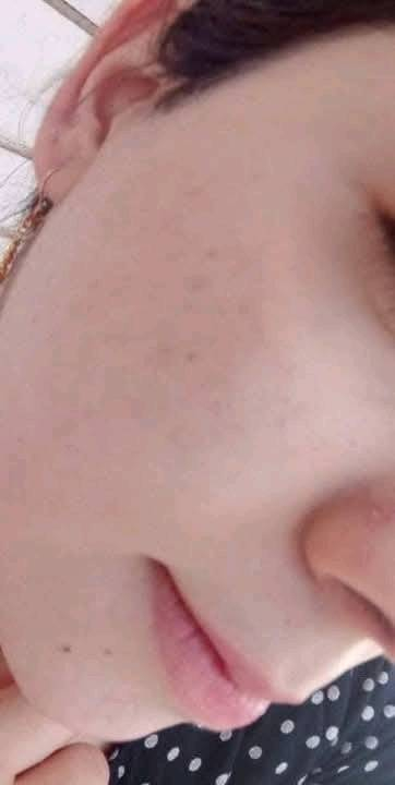 خلطه اصليه  ومجربه وتبين من اول يومين تبيض وتورد  تشد البشره وتعالج التجاعيد وهالات تحت العين والكلف وآثار حب  الشباب والنمش وعدنا الي تسمن ولي متسمن حسب رغبه الزبونسعر 20 توصيل مجاني لجميع المحافظات للحجز ارسال الرقم والعنوان


**إذا كنت صاحب هذا الإعلان وتريد حذفه لأي سبب، رجاءا أرسل رسالة إلى الدعم الفني**