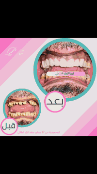 تقويم الأسنان • فحص مجاني • المحمودية بغداد