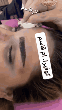 السلام عليكم بنات تخفيض المدة اسبوـع 35 فايبروز
#وتساب الحجز/***********
