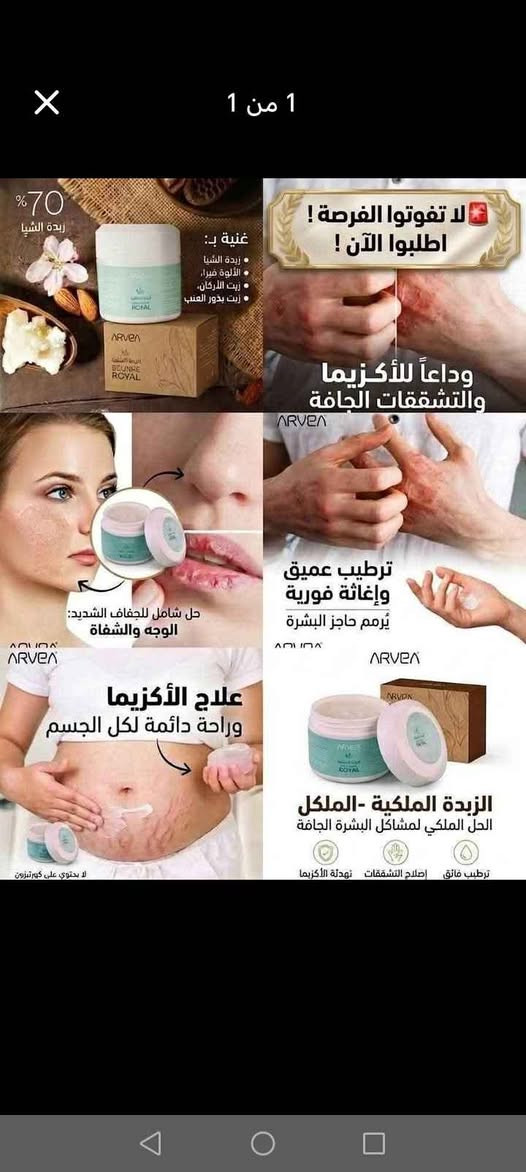 تتكون من 70٪ زبدة الشيا ، زيت الأرغان ، زيت اللوز الحلو، زيت بذور العنب وشمع العسل متعددة الاستعمالات خاصة الترطيب العميق الاكزيما علامات تقدم السن وعلامات تمدد الجسم باتنة, الجزائر


**إذا كنت صاحب هذا الإعلان وتريد حذفه لأي سبب، رجاءا أرسل رسالة إلى الدعم الفني**