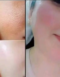 بكج مبيض • تفتيح بشرة • تفتيح جسم