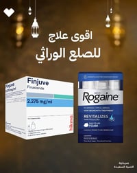 الصلع الوراثي • مينوكسيديل • فيناسترايد