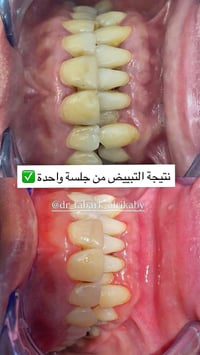 عيادة الغدير لطب وتجميل الأسنان  📍قرب فلكة الصدرين / بناية الدكتور الص...