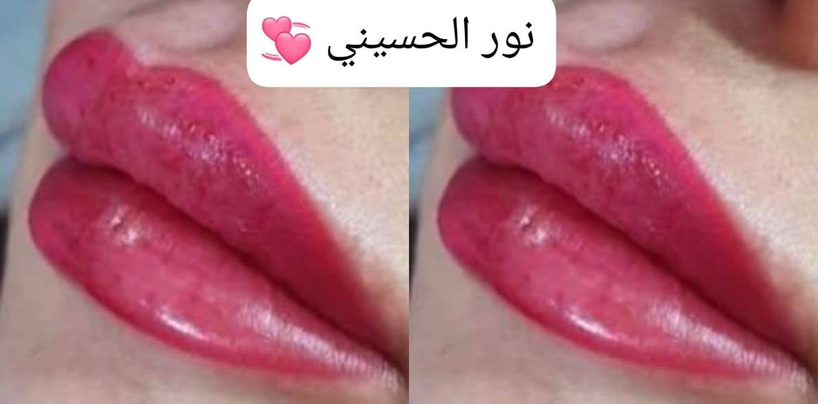 إذا تريدين الجمال والذوق بمكان واحد، وجهتچ تكون صالون شانيل نور الحسيني ✨🤍
بصراحة شغلهم كلش مرتب، نظافة، ذوق بالتعامل وإبداع بكل التفاصيل 😍💇‍♀️
والأحلى عندهم خدمات متنوعة حتى تطلعين بأحلى لوك وبكل مناسباتچ 💕
✨ صبغ شعر، ميش وهايلايت
✨ تسريحات حتى للشعر الأفريقي
✨ تنظيف بشرة VIP
✨ جهاز ديرمابن + قناع الضوء الأوبرا الملكية
✨ حفافه وتنظيف قدم
✨ تاتو بأنواعه ووشم
✨ توريد شفايف
✨ تركيب رموش بأنواعها
✨ مكياج وتسريحات للمدعوات
✨ معالج حار وبارد
كلشي يخص جمالچ موجود بمكان واحد وبإيدين محترفة 🌷✨
صالون شانيل نور الحسيني… لأن جمالچ يستاهل الأفضل 🤍
الحسينيه السكلات ال 13
***********
