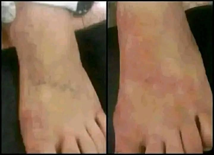 مستعدون لإزالة جميع انواع الوشوم القديمة والحديثة بأحدث الأجهزة 
البصرة الجمهورية تقاطع معهد النفط قرب الريان سنتر للألعاب فوق قاعه الكوكب للرشاقة الطابق الثالث مصعد اكو *********** اتصال وواتساب البصرة, العراق
