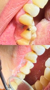 علاج اسنان • مجاني • عيادات جامعة المنارة