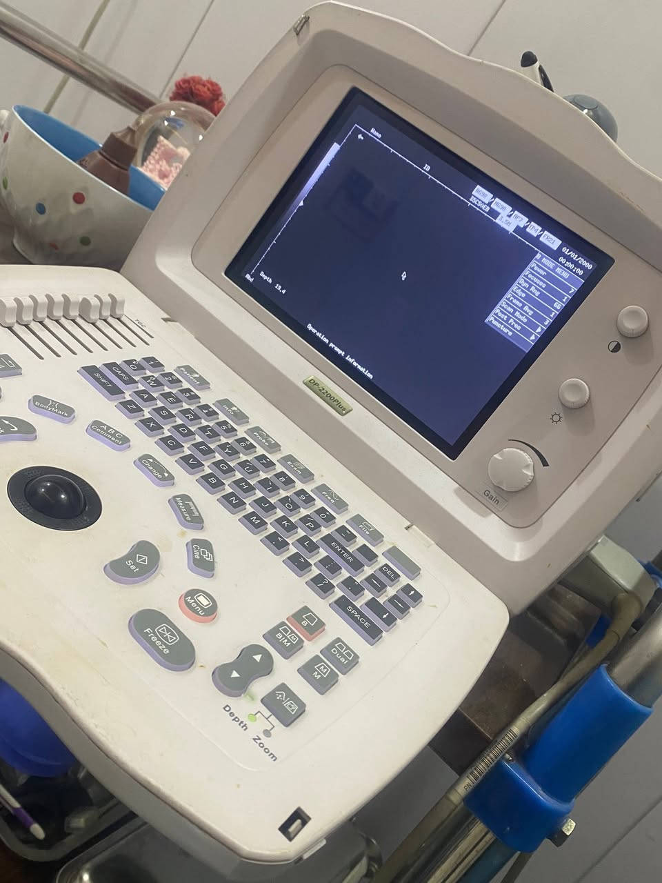 السلام عليكم 
جهاز سونر PD2200 plus للبيع
من شركه مندري


**إذا كنت صاحب هذا الإعلان وتريد حذفه لأي سبب، رجاءا أرسل رسالة إلى الدعم الفني**