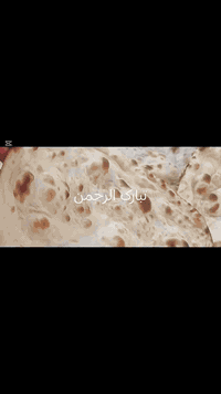 تستلم طحين • خبز غاز • حي الوحده