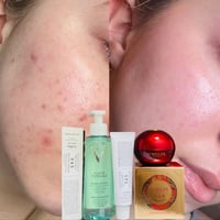 طقم عناية بالبشرة • يصفي الحبوب • كريم مبيض