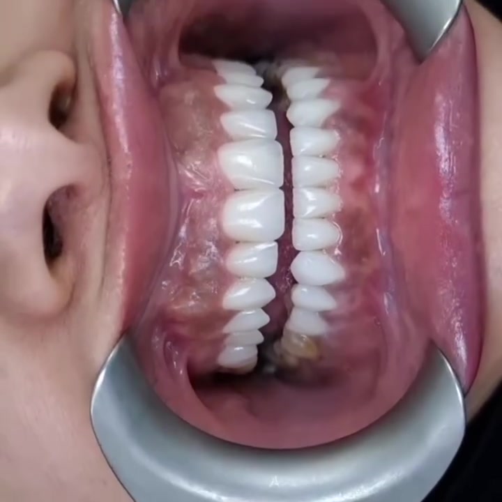 ✨ ابتسامتك تبدأ من مركز سما المناذرة لطب الأسنان ✨

لأن ابتسامتك تستحق الأفضل، نقدم لكم رعاية متكاملة بأحدث الأجهزة وعلى أيدي أطباء ذوي خبرة.

✅ جودة في العلاج
✅ تعقيم وفق أعلى المعايير
✅ أسعار مناسبة وخدمة مميزة

📍 مركز سما المناذرة لطب الأسنان

العنوان / النجف الاشرف _ المناذرة _ الشارع العام _ قرب مستشفى
 المناذرة _عمارة الحاج ابو نبيل جانب صيدلية الأصالة
 للحجز والأستفسار / ***********
الساعه 9:00 صباحا الساعه 1:00 ظهرا من الساعه 3:00 ظهرا الى الساعه 9:00 ليلا ًَ

#تقويم_اسنان #زراعة_الاسنان #تغليف_اسنان #تجميل_اسنان #حشوات_تجميلية
