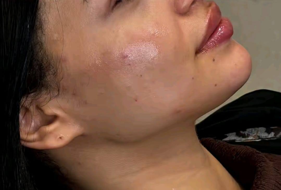 السيسي الواحد 25 الف
مدينة الصدر الكياره قطاع٦٧ مقابل نادي الجولان عيادة ايفا لتجميل الوجه والأسنان


**إذا كنت صاحب هذا الإعلان وتريد حذفه لأي سبب، رجاءا أرسل رسالة إلى الدعم الفني**