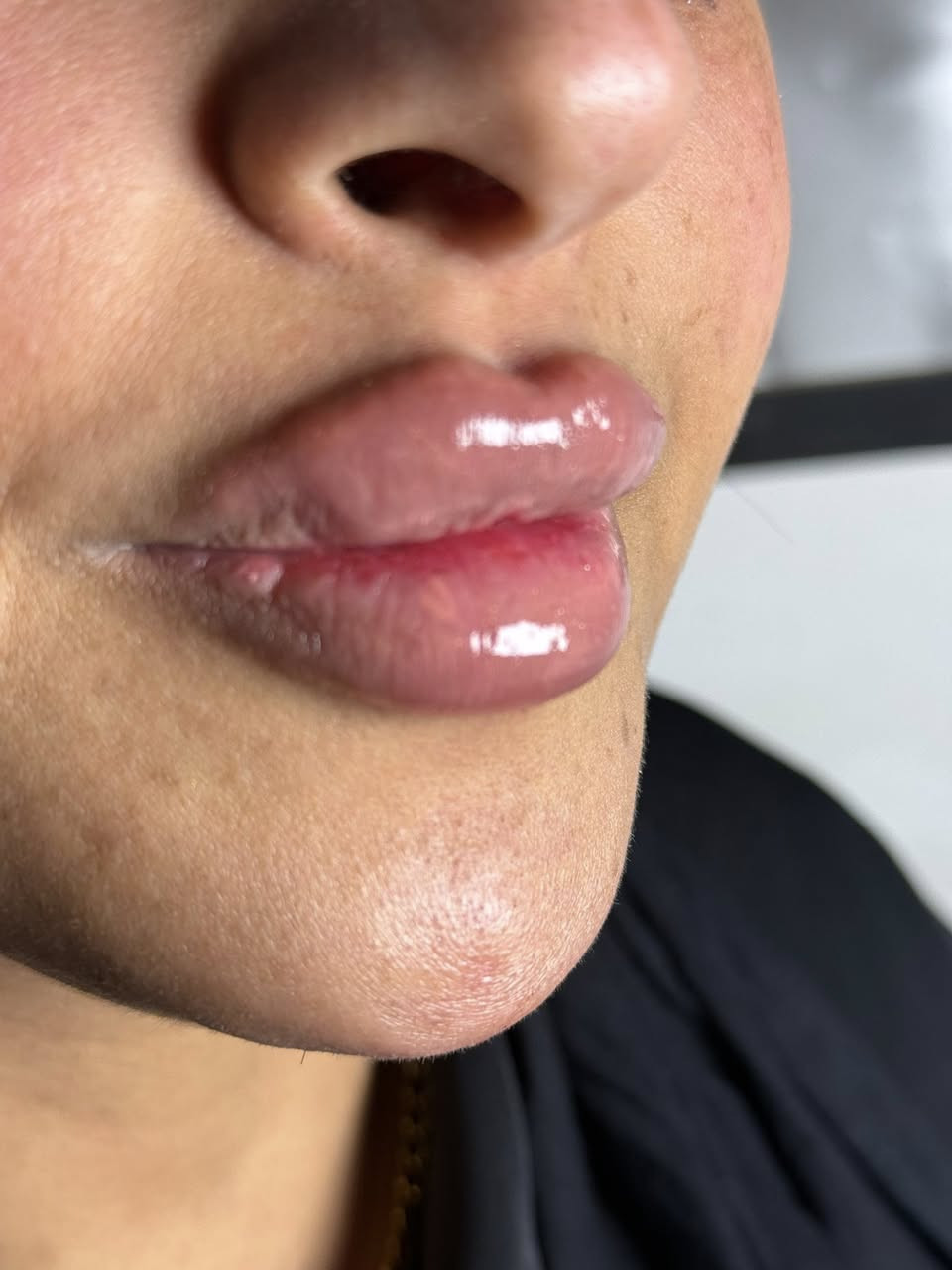 فلر شفة
بدأ تغيييرات العيد حبايب 

احسن شي ممكن تسوونه هسة طبعا الطراوة. تموت لان فلر براند 

العنوان العبيدي مقابل مطعم ليالينا سوق العبيدي مجمع الأمير الطبي الطابق الأول عيادة الدكتورة حوراء الدراجي *********** للحجز
