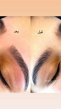 حفافه • تنظيف بشره • الصويرة